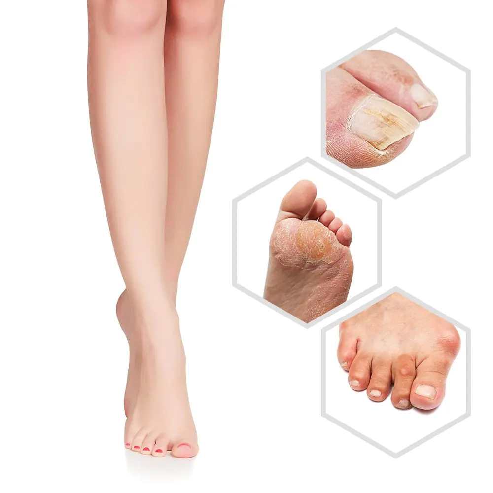 Electric Foot Grinder with Battery for Pedicure Care - Image 3