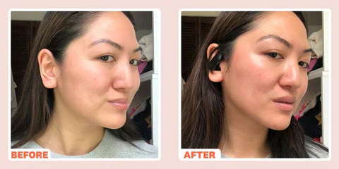 Microcurrent Face Toner - Image 3