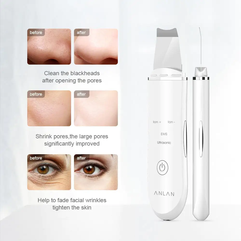 Ultrasonic Skin Scrubber - Image 3
