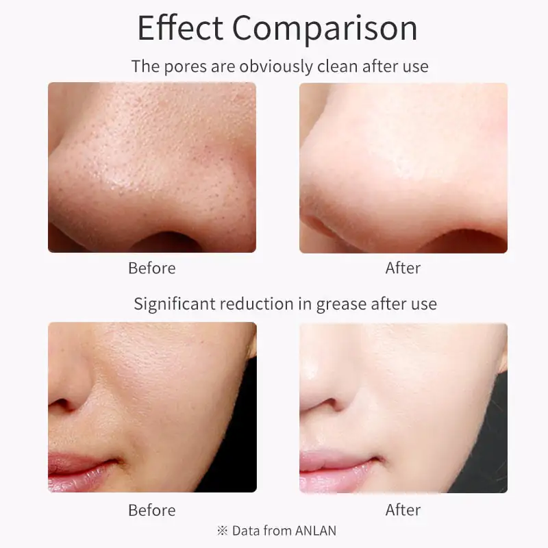 Ultrasonic Skin Scrubber - Image 6